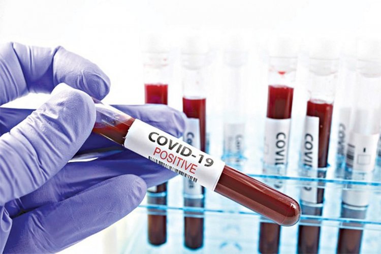 COVID-19 : Nigeria's Total Infection Surpass 65,000, 152 New Cases Recorded