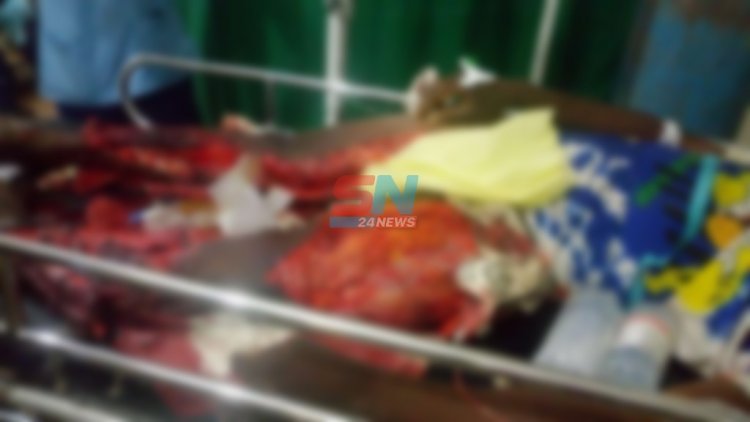 One Dead, One other battling for his life after an Accident in Wenchi