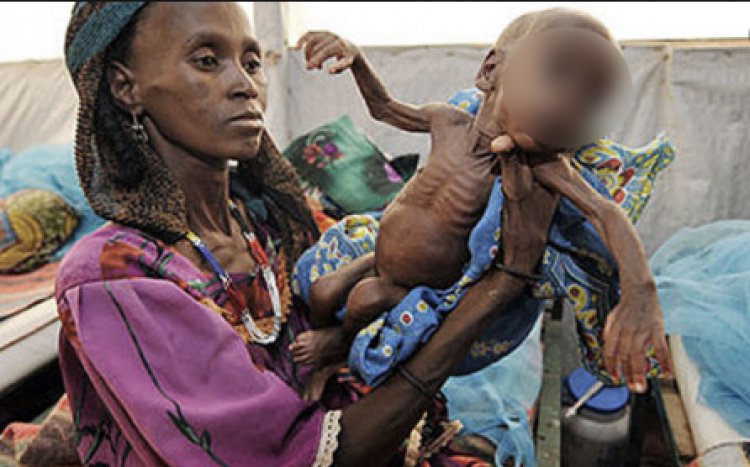 Some 350,000 Ethiopians in famine conditions - UN