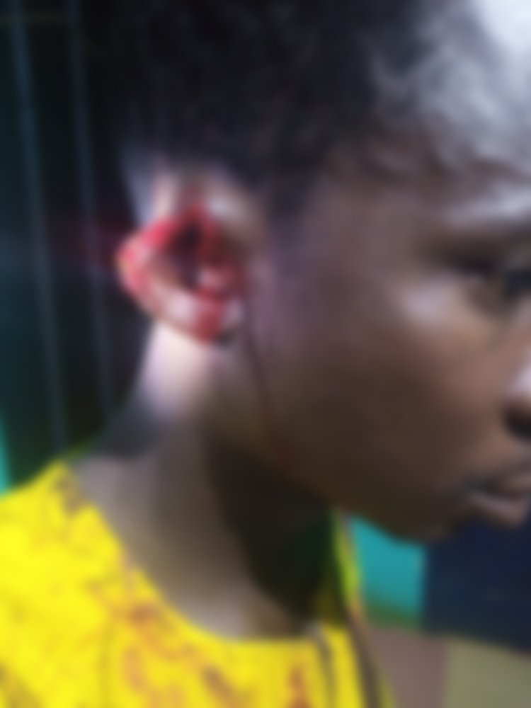 Isaac Atigha bites off friend's ear over wee soup