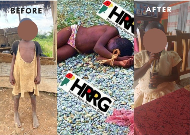 Human Rights Reporters Ghana gets results: 7-year-old girl brutally assaulted, tortured by father rescued