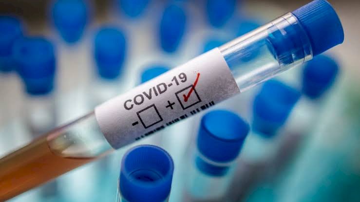 COVID-19: Nigeria Confirmed Cases Rises To 2,950, 98 Deaths Recorded