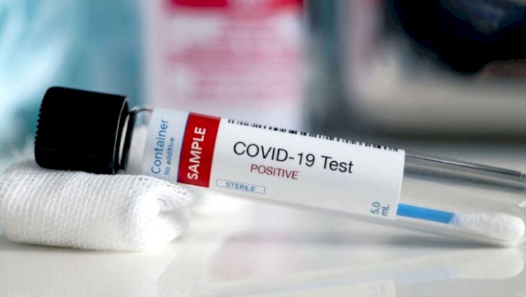 COVID-19: A 9-Year-Old Tests Positive In Enugu